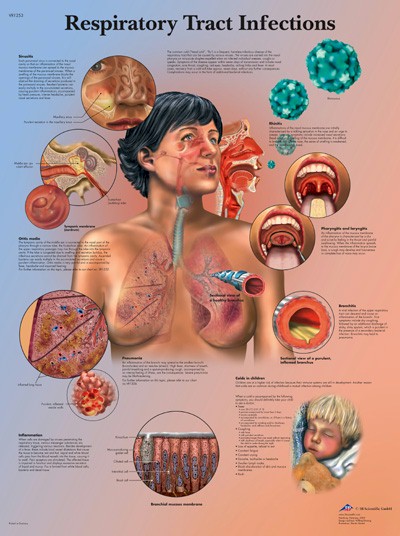 Wandkaart: Respiratory Tract Infections
