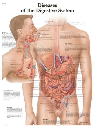 Wandkaart: Diseases Of The Digestive System