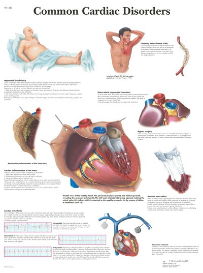 Wandkaart: Common Cardiac Disorders