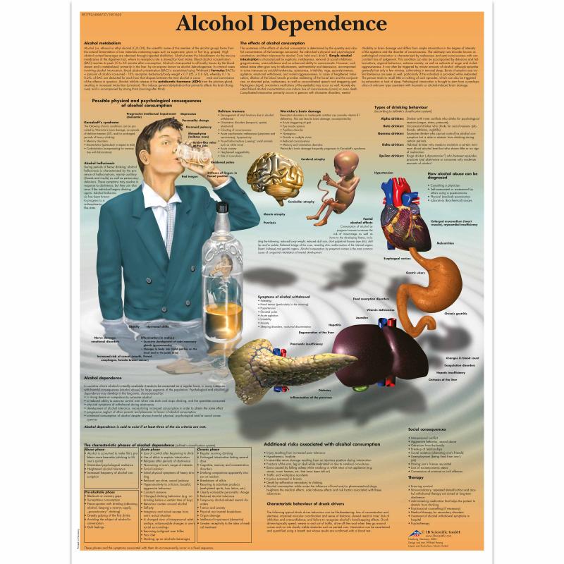 Wandkaart: Alcohol Dependence